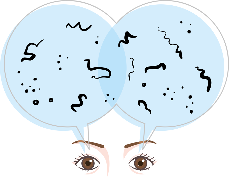 Eye floaters diagram