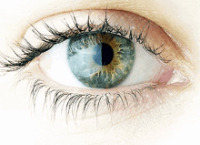 Corneal Cross Linking