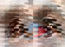 Woman With Red Eye 5S4LQ3T Scaled (1)