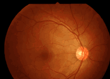 What Can Opticians Tell From Your Eyes