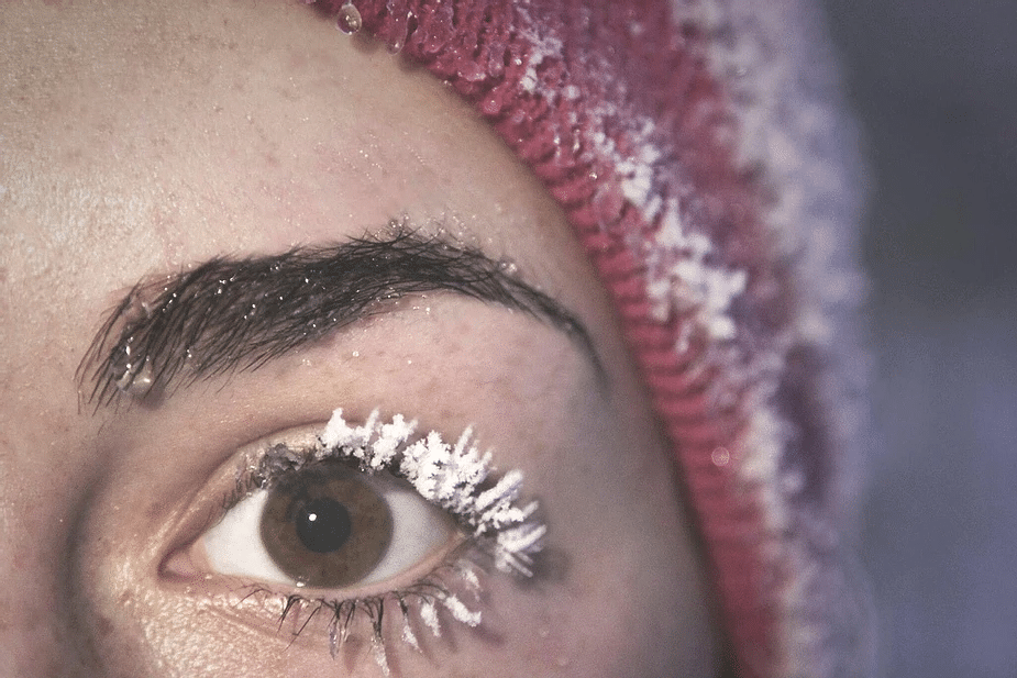 Woman suffering from dry eyes during winter