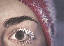 Dry Eyes Worse In Winter