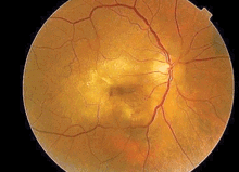 Shadows In My Vision