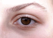 Eye Constantly Twitiching