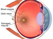 Bc95b8 30D498208aaa4d02a9d5e1e83b28da1c Mv2