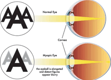 Seeing Shadows On Letters