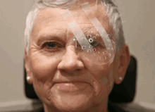 Cataract Surgery