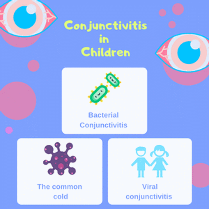 conjunctivits in children